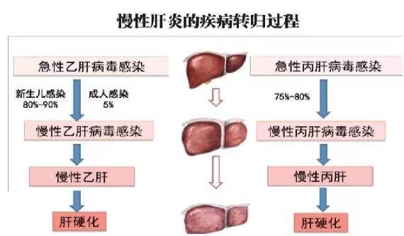 【健康科普】世界肝炎日——堅(jiān)持早預(yù)防，加強(qiáng)檢測(cè)發(fā)現(xiàn)，規(guī)范抗病毒治療